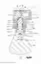 Fig. 13 - Orthopedic implant system