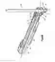 Fig. 19 - Orthopedic implant system