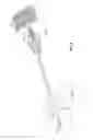 Fig. 05 - Methods and apparatus for treating vertebral fractures