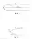 Fig. 18 - Methods and apparatus for treating vertebral fractures