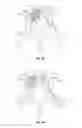 Fig. 26 - Methods and apparatus for treating vertebral fractures