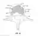 Fig. 27 - Methods and apparatus for treating vertebral fractures