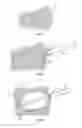 Fig. 02 - METHODS AND APPARATUS FOR TREATING VERTEBRAL FRACTURES