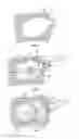 Fig. 03 - METHODS AND APPARATUS FOR TREATING VERTEBRAL FRACTURES