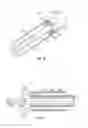 Fig. 05 - METHODS AND APPARATUS FOR TREATING VERTEBRAL FRACTURES
