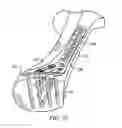 Fig. 04 - Ankle tibia plates