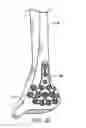 Fig. 07 - Ankle tibia plates