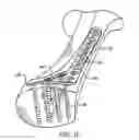 Fig. 04 - Ankle tibia plates