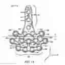 Fig. 05 - Ankle tibia plates