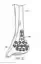 Fig. 07 - Ankle tibia plates