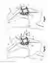 Fig. 09 - Patella bone plate and methods of fixation