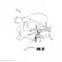 Fig. 25 - Systems and methods for tissue ablation