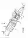 Fig. 04 - Methods and systems for spinal radio frequency neurotomy