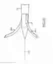 Fig. 15 - Methods and systems for spinal radio frequency neurotomy