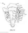 Fig. 18 - Methods and systems for spinal radio frequency neurotomy