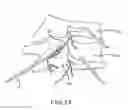 Fig. 19 - Methods and systems for spinal radio frequency neurotomy