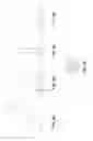 Fig. 09 - Ablation catheter with flexible electrode