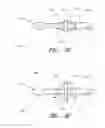 Fig. 08 - Methods of removing biofilm from endotracheal tubes