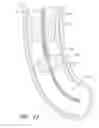 Fig. 21 - Methods of removing biofilm from endotracheal tubes
