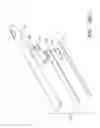 Fig. 27 - Methods of removing biofilm from endotracheal tubes