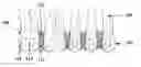 Fig. 01 - Tooth-positioning appliance, systems and methods of producing and using the same