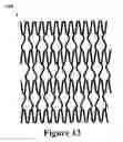 Fig. 13 - Tooth-positioning appliance, systems and methods of producing and using the same