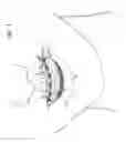 Fig. 02 - Bracket system