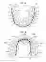 Fig. 03 - Bracket system