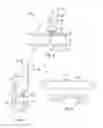 Fig. 11 - Method and apparatus for restoring improper morphology of the alveolar bone
