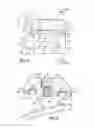 Fig. 04 - Orthodontic brackets