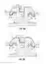 Fig. 05 - Orthodontic brackets