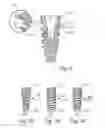 Fig. 04 - Dental implant