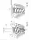 Fig. 05 - Dental implant