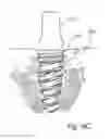 Fig. 06 - Dental implant