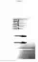 Fig. 03 - BONE REAMER USED IN THE INTERNAL SINUS LIFTING PROCEDURE OF DENTAL IMPLANTATION