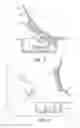Fig. 05 - Container for orthodontic appliances