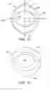 Fig. 06 - Stress urinary incontinence treatment device, method and tools