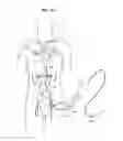 Fig. 14 - Systems and methods for manipulating medical devices