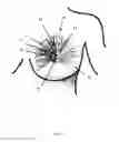 Fig. 05 - Implantable nipple assembly