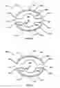 Fig. 09 - ACCOMMODATING INTRAOCULAR LENS WITH OUTER SUPPORT STRUCTURE