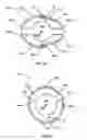 Fig. 11 - ACCOMMODATING INTRAOCULAR LENS WITH OUTER SUPPORT STRUCTURE