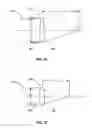 Fig. 12 - ACCOMMODATING INTRAOCULAR LENS WITH OUTER SUPPORT STRUCTURE