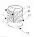 Fig. 01 - Prosthetic valve and method of making a prosthetic valve
