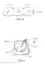 Fig. 07 - Prosthetic heart valve including stent structure and tissue leaflets, and related methods