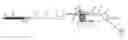 Fig. 01 - Delivery system for prosthetic heart valve
