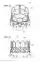 Fig. 08 - Delivery system for prosthetic heart valve