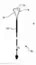 Fig. 01 - System and a method for delivery of an annuloplasty implant