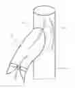 Fig. 01 - Prosthetic valve for treating diseases causing reflux affecting the lower limbs