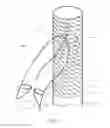 Fig. 03 - Prosthetic valve for treating diseases causing reflux affecting the lower limbs