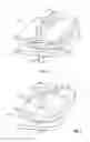 Fig. 02 - Transforaminal prosthetic spinal disc apparatus